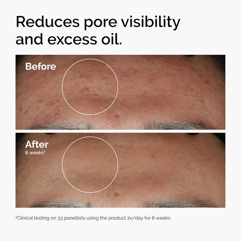 Niacinamide Smoothing Face Serum