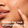 Mighty Patch Hydrocolloid Acne Pimple Patches