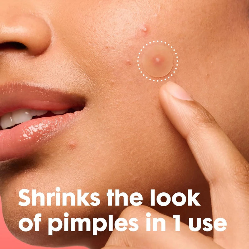 Mighty Patch Hydrocolloid Acne Pimple Patches