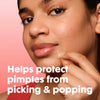 Mighty Patch Hydrocolloid Acne Pimple Patches