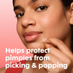 Mighty Patch Hydrocolloid Acne Pimple Patches