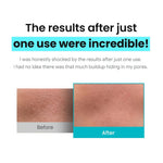ILSO Sebum Softener Cleanser