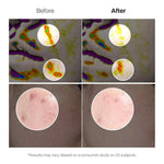 Meditherapy Retinal Skin Booster Serum