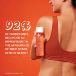 Bio-Oil Skincare Body Oil