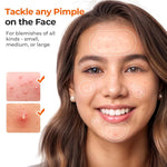 TKTK Hydrocolloid Pimple Patches