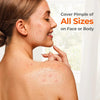TKTK Hydrocolloid Pimple Patches